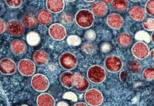 Argentina isola navio proveniente do Brasil após possível caso de mpox, diz governo