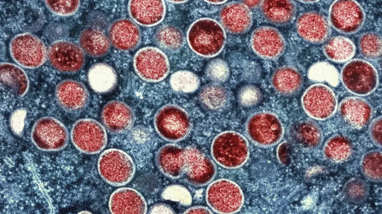 Argentina isola navio proveniente do Brasil após possível caso de mpox, diz governo