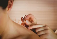 Novo Marco para a acupuntura no Brasil após debates sobre regulamentação da prática